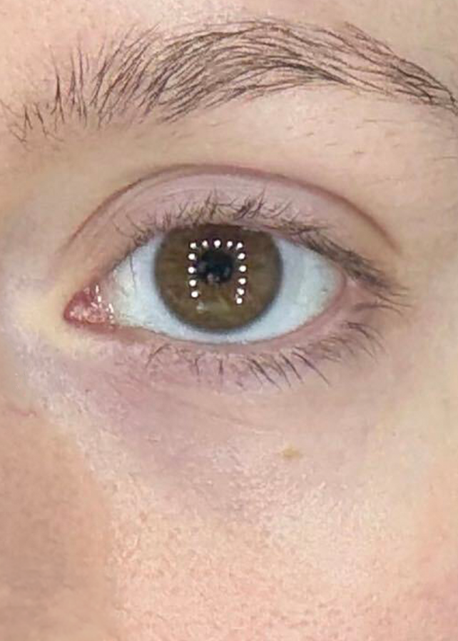 Close-up of a human eye after image for pomegrante eye serum