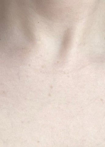 Close-up of a person's bare chest and neck area showing skin texture and freckles, with no visible product or packaging.