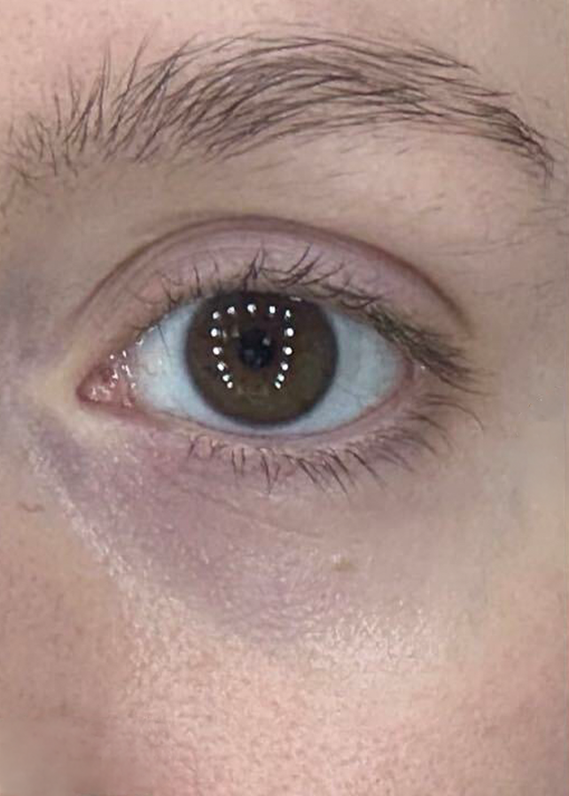 A close-up of a human eye before image for pomegrante eye serum